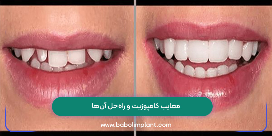 معایب کامپوزیت و راه‌حل آن‌ها