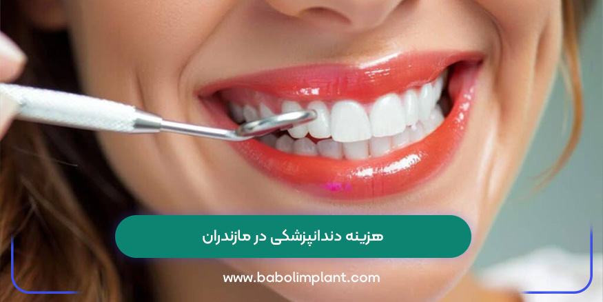 هزینه دندانپزشکی در مازندران