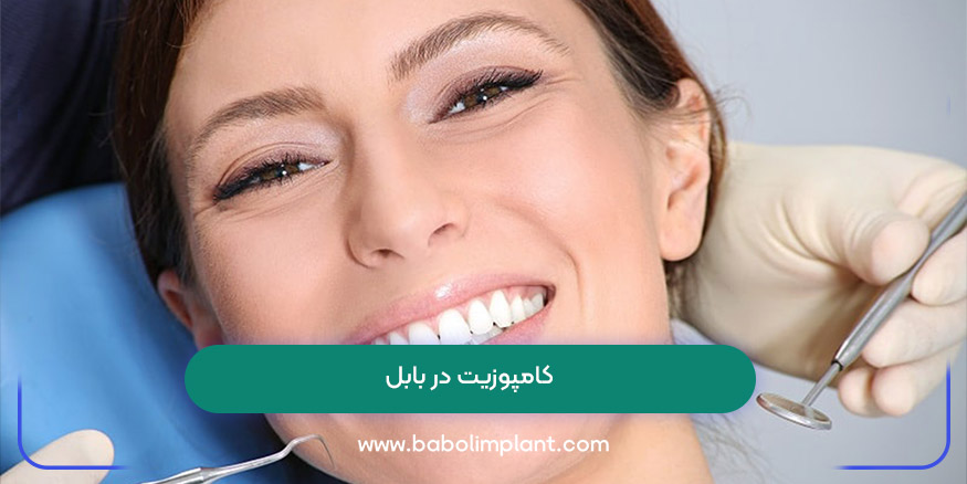 کامپوزیت در بابل