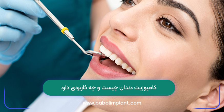 کامپوزیت دندان چیست و چه کاربردی دارد