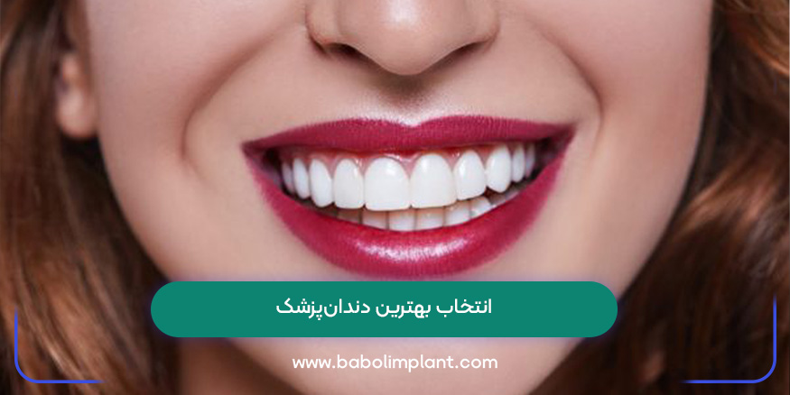 انتخاب بهترین دندان‌پزشک