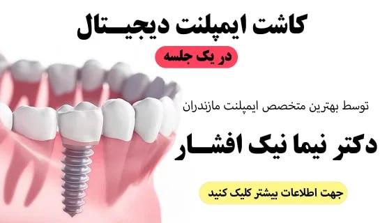 دندانپزشکی با بیمه حافظ در آمل