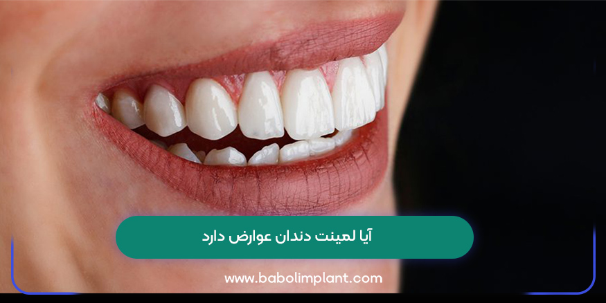 آیا لمینت دندان عوارض دارد
