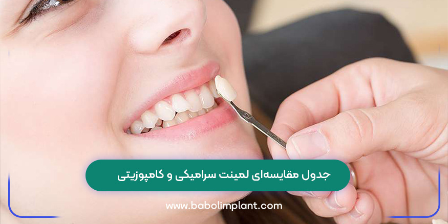 جدول مقایسه‌ای لمینت سرامیکی و کامپوزیتی
