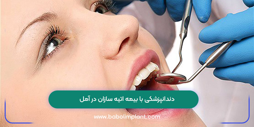 دندانپزشکی با بیمه اتیه سازان در آمل