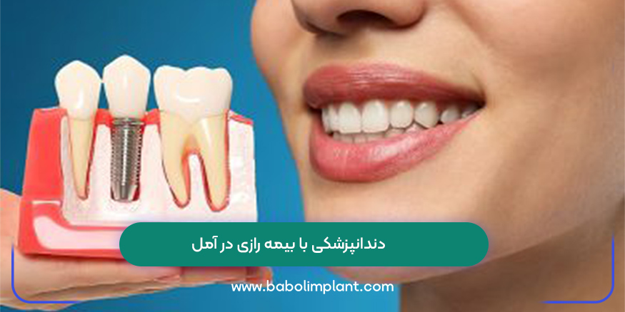 دندانپزشکی با بیمه رازی در آمل