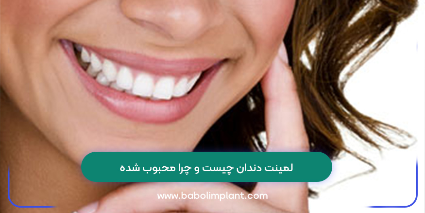 لمینت دندان چیست و چرا محبوب شده
