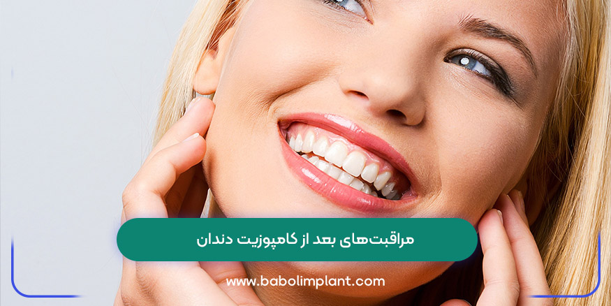 مراقبت‌های بعد از کامپوزیت دندان