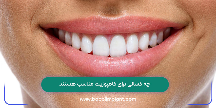 چه کسانی برای کامپوزیت مناسب هستند