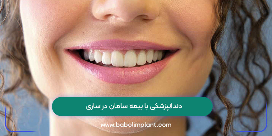 دندانپزشکی با بیمه سامان در ساری