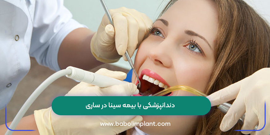 دندانپزشکی با بیمه سینا در ساری