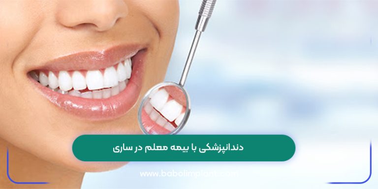 دندانپزشکی با بیمه معلم در ساری