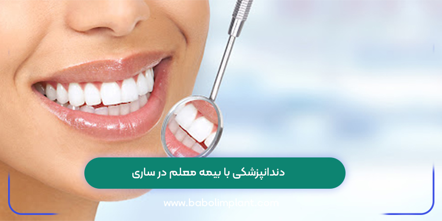 دندانپزشکی با بیمه معلم در ساری