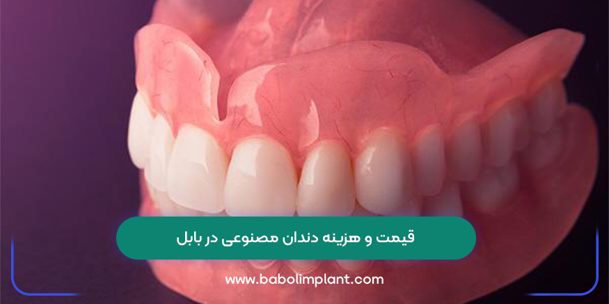قیمت و هزینه دندان مصنوعی در بابل