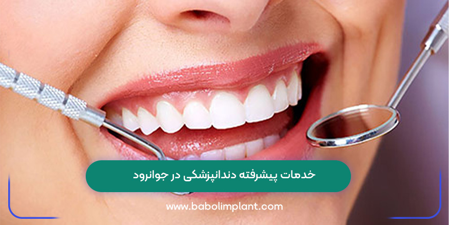 Advanced dental services in Javanroud-1.jpg