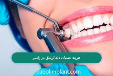 Cost of dental services in Ramsar