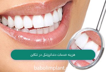 Cost of dental services in Tonekabon