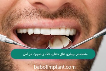 Oral and maxillofacial specialist in Amol