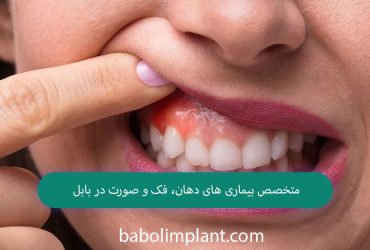 Oral and maxillofacial specialist