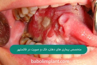 Oral and maxillofacial specialist in Ghaemshahr