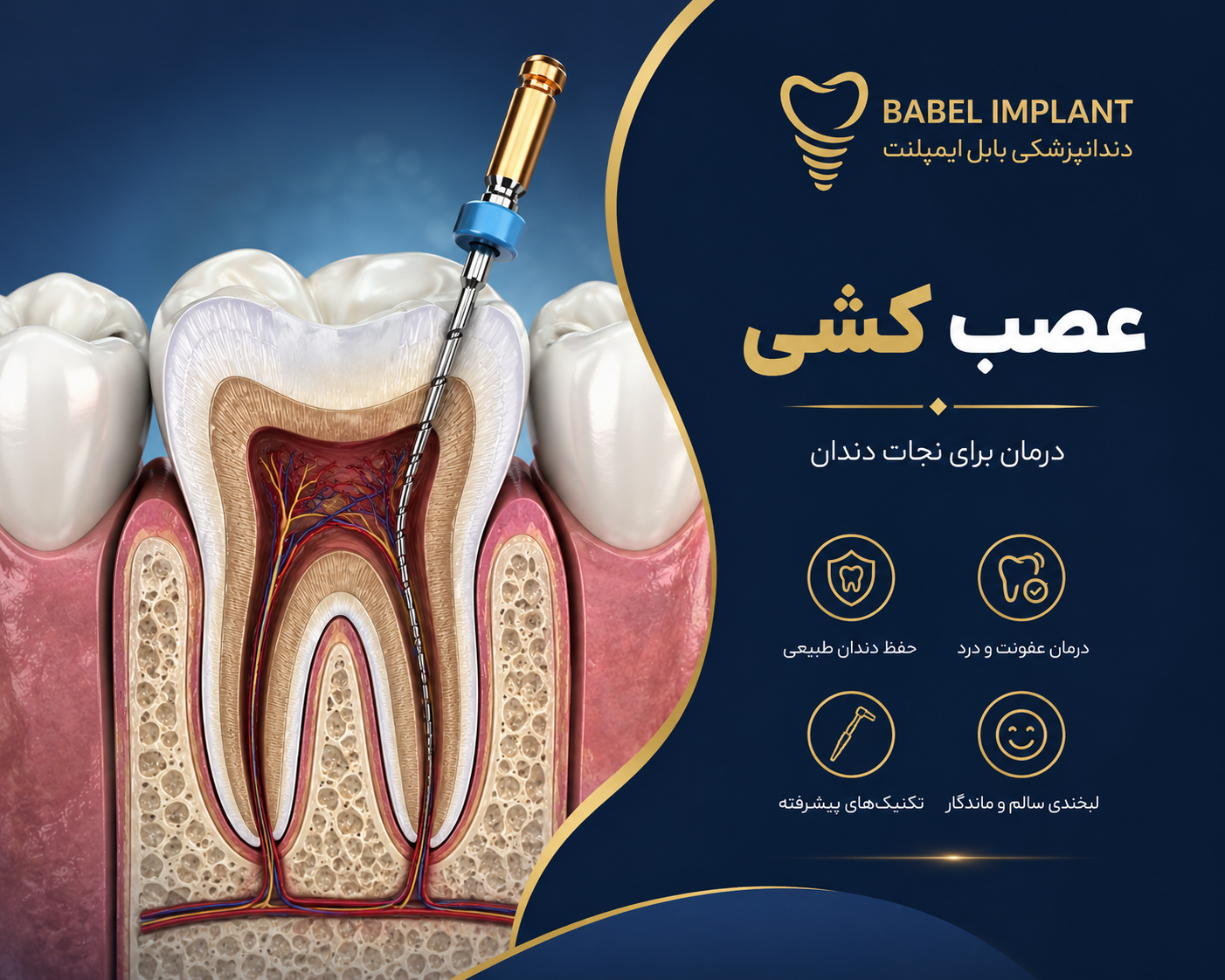 What are the steps for performing a nerve ablation?