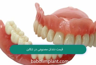 Denture prices in Tonekabon