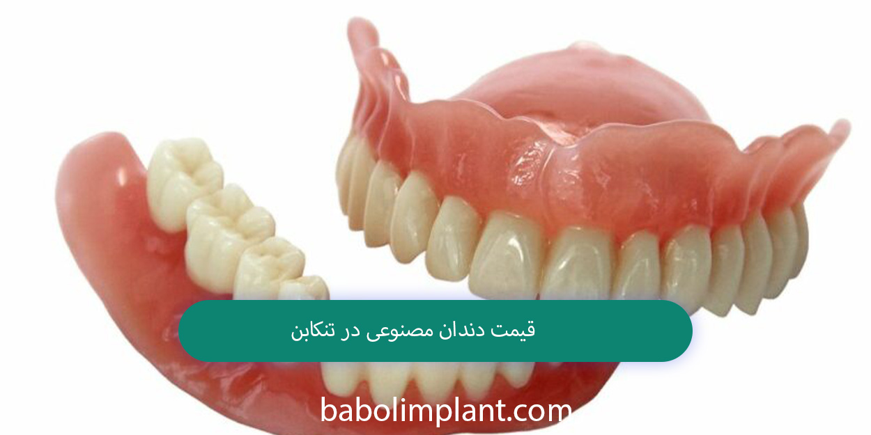 Denture prices in Tonekabon