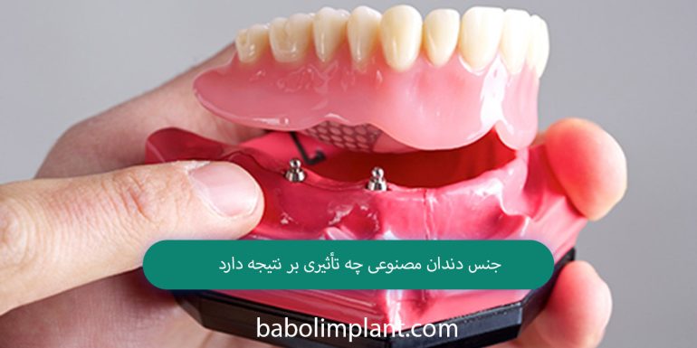 How does the type of denture affect the result?