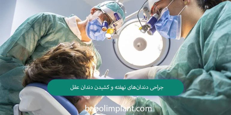 Impacted teeth surgery and wisdom tooth extraction
