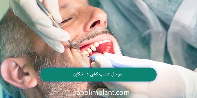 Nephrology procedures in Tonekabon