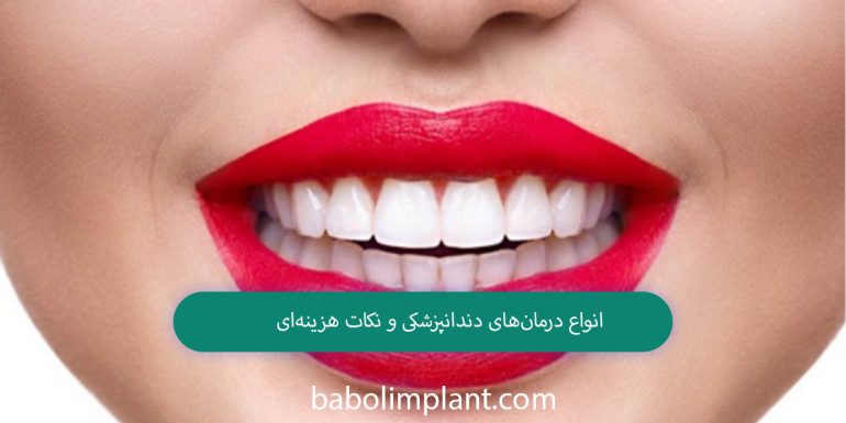 Types of dental treatments and cost tips