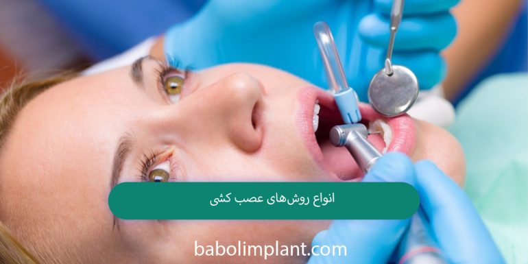 Types of nerve ablation methods