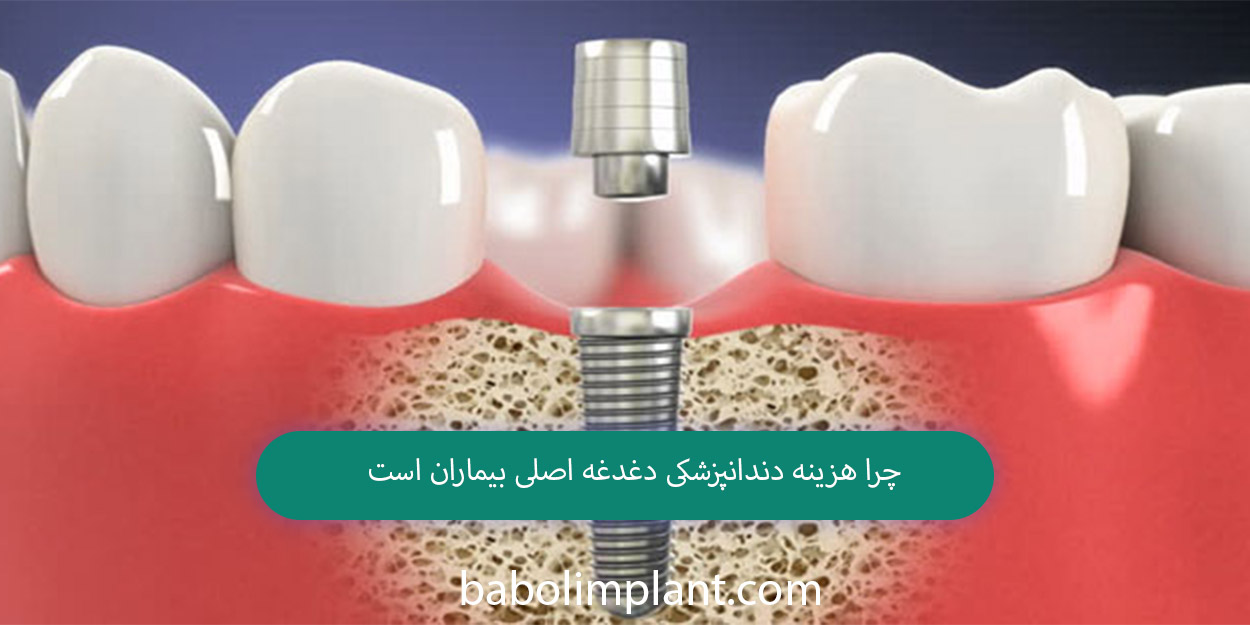 Why dental costs are a major concern for patients