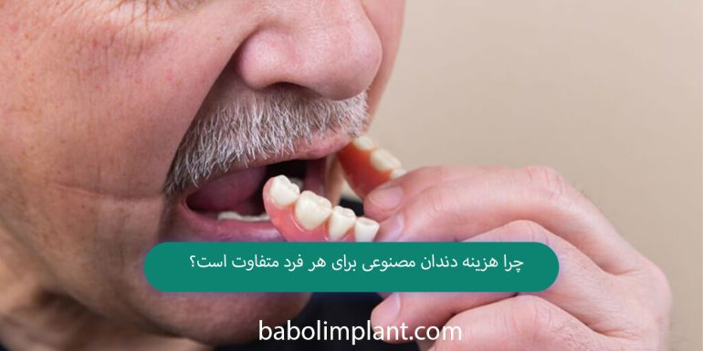 Why does the cost of dentures vary for each person?