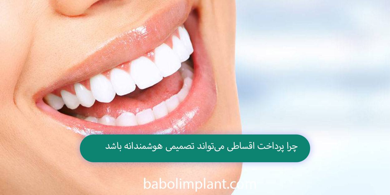 Why paying in installments can be a smart decision