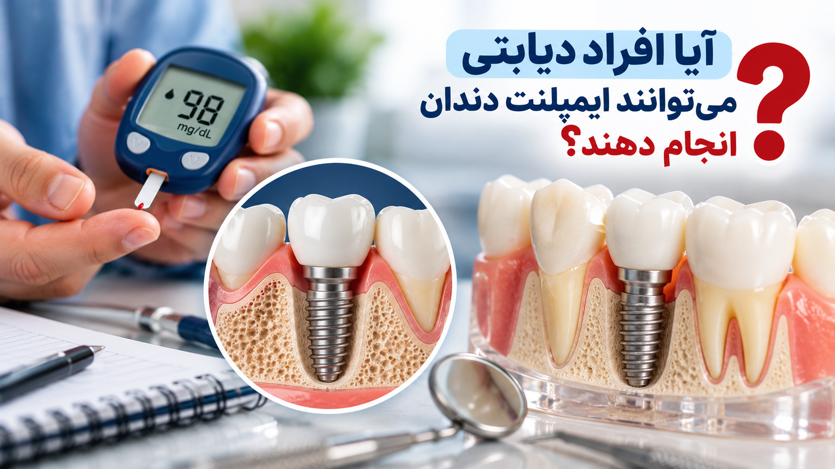 آیا افراد دیابتی می‌توانند ایمپلنت دندان انجام دهند