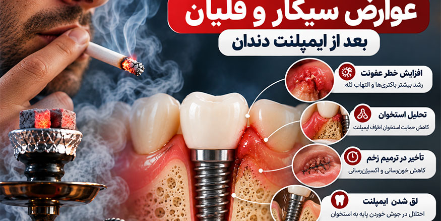 عوارض سیگار و قلیان بعد از ایمپلنت دندان