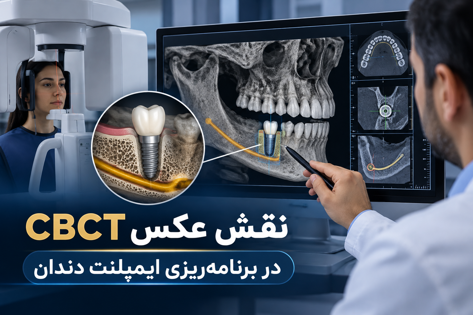 نقش عکس CBCT در برنامه‌ریزی ایمپلنت دندان
