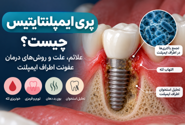 پری‌ایمپلنتایتیس چیست